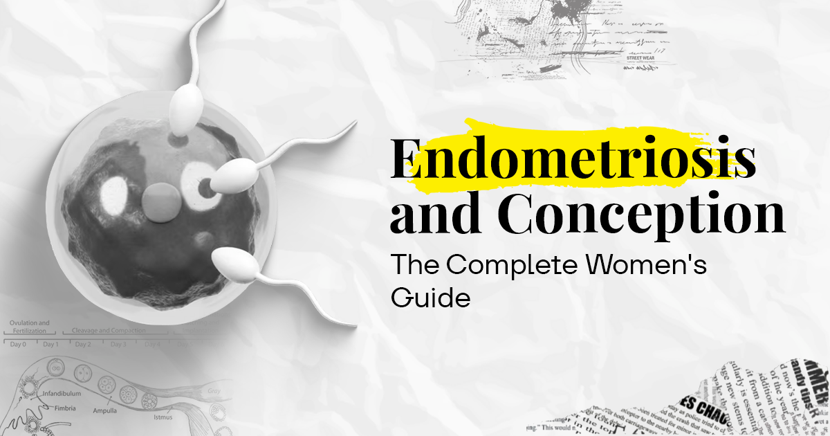 Endometriosis and conception